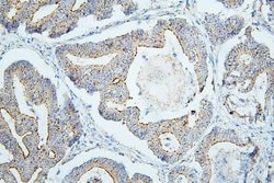 Invitrogen PDCD6IP Monoclonal Antibody (14D10) 100 &mu;g; Unconjugated:Antibodies,