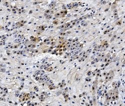 Invitrogen HMG4 Monoclonal Antibody (7G13) 100 &mu;g; Unconjugated:Antibodies,