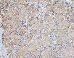 Invitrogen COPE Monoclonal Antibody (9B6) 100 &mu;g; Unconjugated:Antibodies,