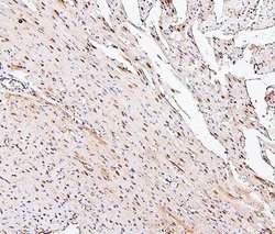 Invitrogen PPCS Monoclonal Antibody (7G13) 100 &mu;g; Unconjugated:Antibodies,