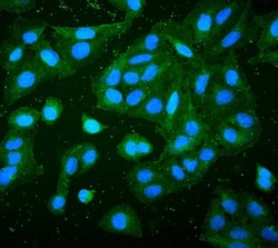 Invitrogen RP2 Monoclonal Antibody (3D7) 100 &mu;g; Unconjugated:Antibodies,