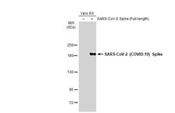 Invitrogen SARS-CoV-2 Spike Protein S1 Monoclonal Antibody (GT263) 100