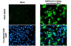 Invitrogen SARS-CoV-2 Spike Protein S1 Monoclonal Antibody (GT263) 100