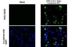 Invitrogen SARS-CoV-2 Spike Protein S1 Monoclonal Antibody (GT263) 100