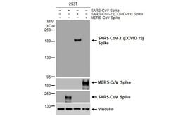 SARS-CoV-2 Spike Protein S1 Recombinant Rabbit Monoclonal Antibody (HL1), Invitrogen 100 &mu;L | Buy Online | Thermo Scientific | Fisher Scientific