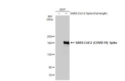 SARS-CoV-2 Spike Protein S1 Recombinant Rabbit Monoclonal Antibody (HL1), Invitrogen 100 &mu;L | Buy Online | Thermo Scientific | Fisher Scientific
