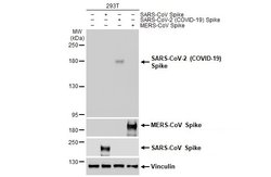 Invitrogen SARS-CoV-2 Spike Protein S1 Recombinant Rabbit Monoclonal Antibody (HL263) 100 &mu;L | Buy Online | Invitrogen&trade; | Fisher Scientific