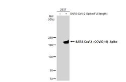 Invitrogen SARS-CoV-2 Spike Protein S1 Recombinant Rabbit Monoclonal Antibody (HL263) 100 &mu;L | Buy Online | Invitrogen&trade; | Fisher Scientific