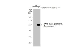 Invitrogen SARS-CoV-2 Nucleocapsid Recombinant Rabbit Monoclonal Antibody