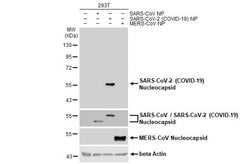 Invitrogen SARS-CoV-2 Nucleocapsid Recombinant Rabbit Monoclonal Antibody