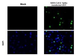 Invitrogen SARS-CoV-2 Spike Protein (RBD) Recombinant Rabbit Monoclonal Antibody (HL257) 100 &mu;L | Buy Online | Invitrogen&trade; | Fisher Scientific