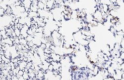 Invitrogen SARS-CoV-2 Spike Protein (RBD) Recombinant Rabbit Monoclonal Antibody (HL257) 100 &mu;L | Buy Online | Invitrogen&trade; | Fisher Scientific