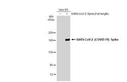 Invitrogen SARS-CoV-2 Spike Protein (RBD) Recombinant Rabbit Monoclonal Antibody (HL257) 100 &mu;L | Buy Online | Invitrogen&trade; | Fisher Scientific