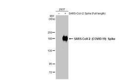 Invitrogen SARS-CoV-2 Spike Protein (RBD) Recombinant Rabbit Monoclonal Antibody (HL257) 100 &mu;L | Buy Online | Invitrogen&trade; | Fisher Scientific