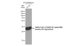 Invitrogen SARS-CoV-2 Spike Protein (RBD) Recombinant Rabbit Monoclonal Antibody (HL257) 100 &mu;L | Buy Online | Invitrogen&trade; | Fisher Scientific