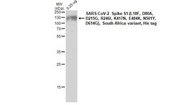Invitrogen SARS-CoV-2 Spike Protein (RBD) Recombinant Rabbit Monoclonal Antibody (HL257) 100 &mu;L | Buy Online | Invitrogen&trade; | Fisher Scientific