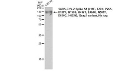 Invitrogen SARS-CoV-2 Spike Protein (RBD) Recombinant Rabbit Monoclonal Antibody (HL257) 100 &mu;L | Buy Online | Invitrogen&trade; | Fisher Scientific