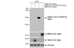 Invitrogen SARS-CoV-2 Spike Protein (RBD) Recombinant Rabbit Monoclonal Antibody (HL257) 100 &mu;L | Buy Online | Invitrogen&trade; | Fisher Scientific