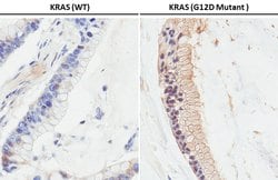 Invitrogen Ras (G12D Mutant) Recombinant Rabbit Monoclonal Antibody (HL10)