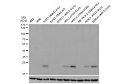 Invitrogen Ras (G12D Mutant) Recombinant Rabbit Monoclonal Antibody (HL10)