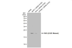 Invitrogen Ras (G12D Mutant) Recombinant Rabbit Monoclonal Antibody (HL10)