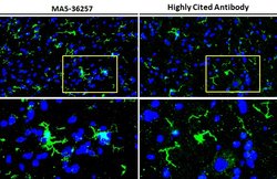 Invitrogen IBA1 Recombinant Rabbit Monoclonal Antibody (HL22) 100 &mu;L;