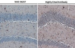 Invitrogen IBA1 Recombinant Rabbit Monoclonal Antibody (HL22) 100 &mu;L;