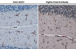 Invitrogen IBA1 Recombinant Rabbit Monoclonal Antibody (HL22) 100 &mu;L;