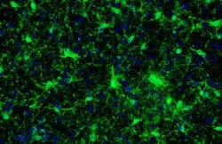 Invitrogen IBA1 Recombinant Rabbit Monoclonal Antibody (HL22) 100 &mu;L;