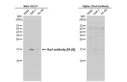 Invitrogen IBA1 Recombinant Rabbit Monoclonal Antibody (HL22) 100 &mu;L;