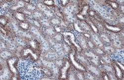 Invitrogen alpha-1 Sodium Potassium ATPase Recombinant Rabbit Monoclonal