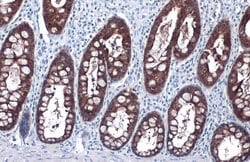 Invitrogen GPX2 Recombinant Rabbit Monoclonal Antibody (HL125) 100 &mu;L;