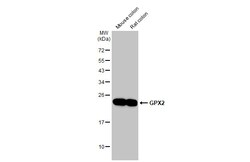 Invitrogen GPX2 Recombinant Rabbit Monoclonal Antibody (HL125) 100 &mu;L;