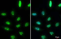 Invitrogen 53BP1 Recombinant Rabbit Monoclonal Antibody (HL275) 100 &mu;L;