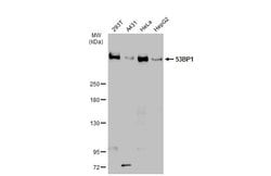 Invitrogen 53BP1 Recombinant Rabbit Monoclonal Antibody (HL275) 100 &mu;L;