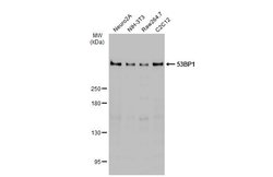 Invitrogen 53BP1 Recombinant Rabbit Monoclonal Antibody (HL275) 100 &mu;L;
