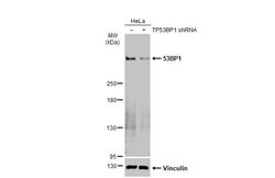 Invitrogen 53BP1 Recombinant Rabbit Monoclonal Antibody (HL275) 100 &mu;L;