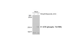 Invitrogen Phospho-ATR (Thr1989) Recombinant Rabbit Monoclonal Antibody (HL132) 100 &mu;L | Buy Online | Invitrogen&trade; | Fisher Scientific