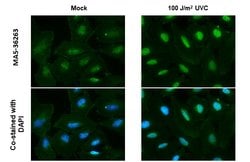 Invitrogen Phospho-ATR (Thr1989) Recombinant Rabbit Monoclonal Antibody