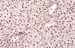 Invitrogen Phospho-ATR (Thr1989) Recombinant Rabbit Monoclonal Antibody