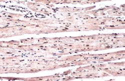 Invitrogen Phospho-ATR (Thr1989) Recombinant Rabbit Monoclonal Antibody