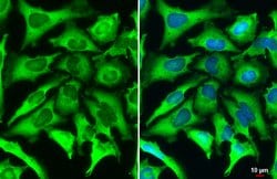 Invitrogen ACSL4 Recombinant Rabbit Monoclonal Antibody (HL229) 100 &mu;L;