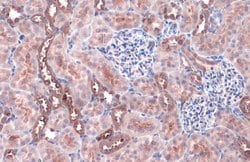 Invitrogen ACSL4 Recombinant Rabbit Monoclonal Antibody (HL229) 100 &mu;L;