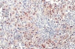 Invitrogen Phospho-ERK1/ERK2 (Thr202, Tyr204, Thr185, Tyr187) Recombinant