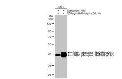 Invitrogen Phospho-ERK1/ERK2 (Thr202, Tyr204, Thr185, Tyr187) Recombinant