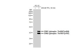 Invitrogen Phospho-ERK1/ERK2 (Thr202, Tyr204, Thr185, Tyr187) Recombinant