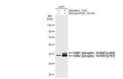 Invitrogen Phospho-ERK1/ERK2 (Thr202, Tyr204, Thr185, Tyr187) Recombinant
