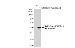 Invitrogen SARS-CoV-2 Nucleocapsid Recombinant Rabbit Monoclonal Antibody