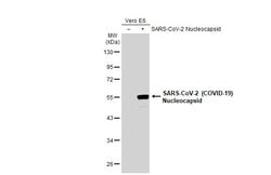 Invitrogen SARS-CoV-2 Nucleocapsid Recombinant Rabbit Monoclonal Antibody