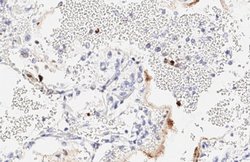 Invitrogen SARS-CoV-2 Nucleocapsid Recombinant Rabbit Monoclonal Antibody